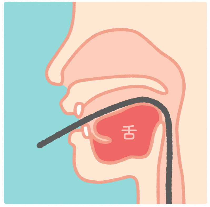 経口
