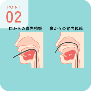POINT 02 胃カメラ検査の挿入方法は口・鼻から選択可